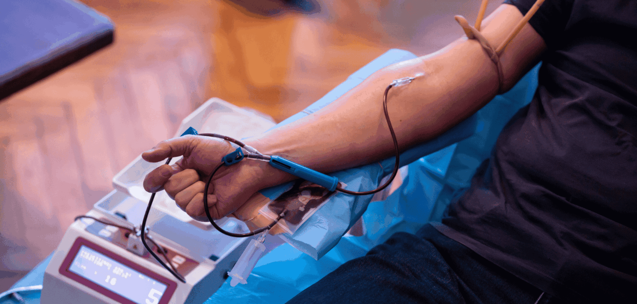 A close-up of a person's arm with a needle and tube attached during a blood donation process.